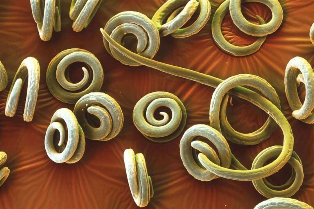 worms parasites of the human body