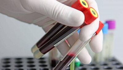 How to take parasite tests in the body