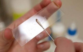 What tests should be done for parasites