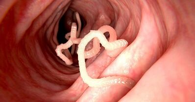 The causes of parasites in the human body